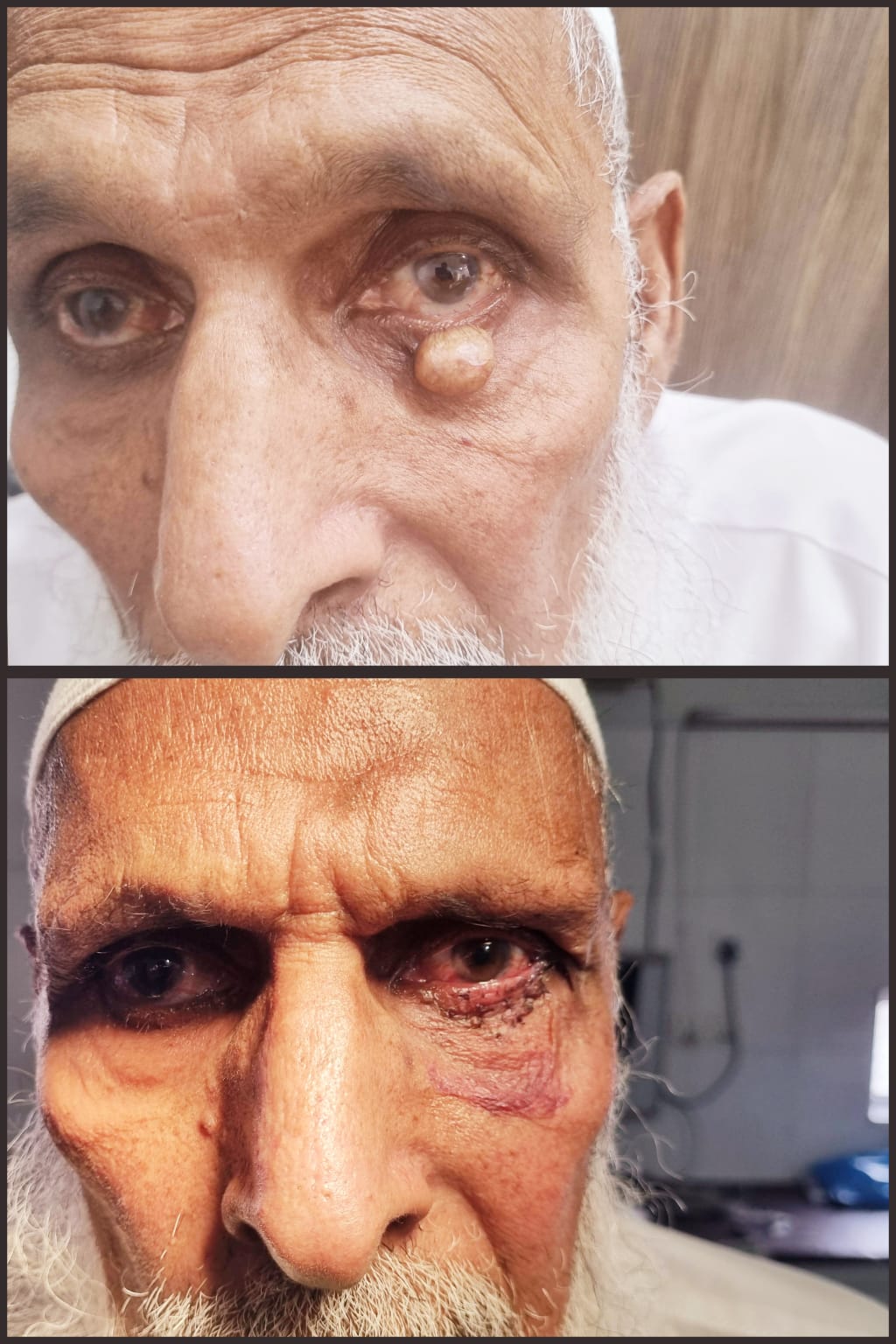Before & After 4